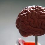 La forma del cerebro podría anticipar la demencia La forma del cerebro podría anticipar la demencia