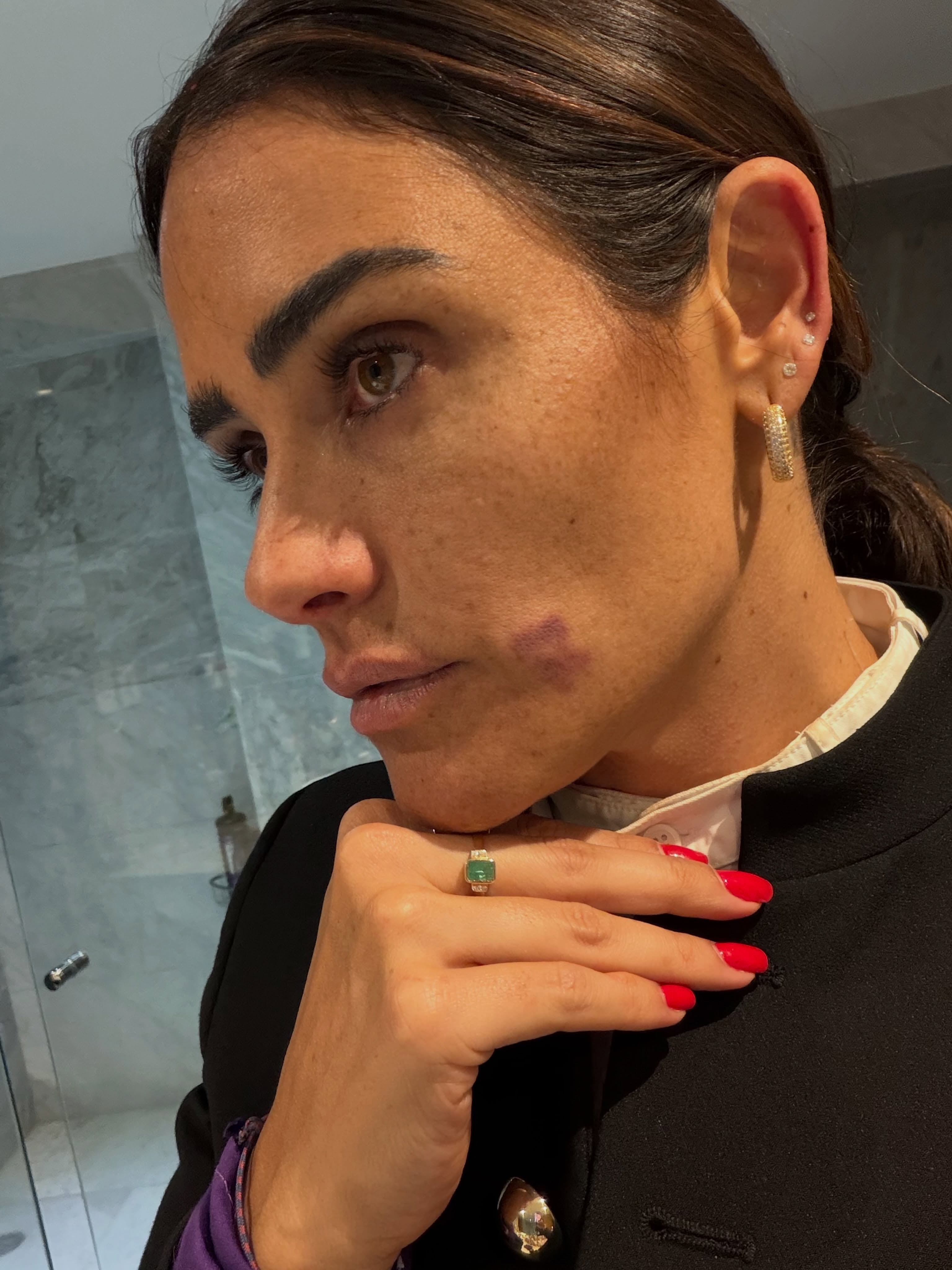 Alessandra Rojo de la Vega acusa agresión en Zona Rosa, CDMX.