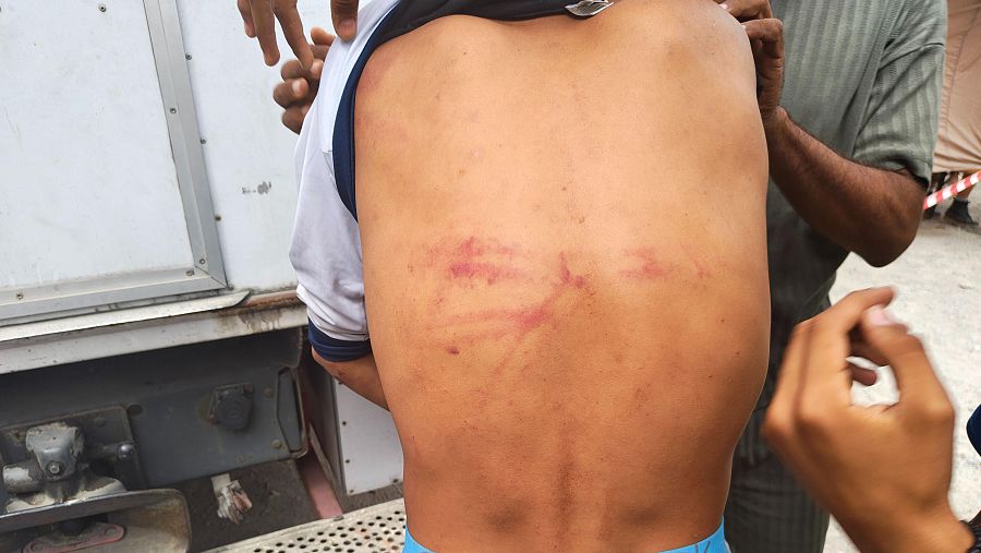 17246390 Migrante herido en la playa de El Trampolín, Ceuta