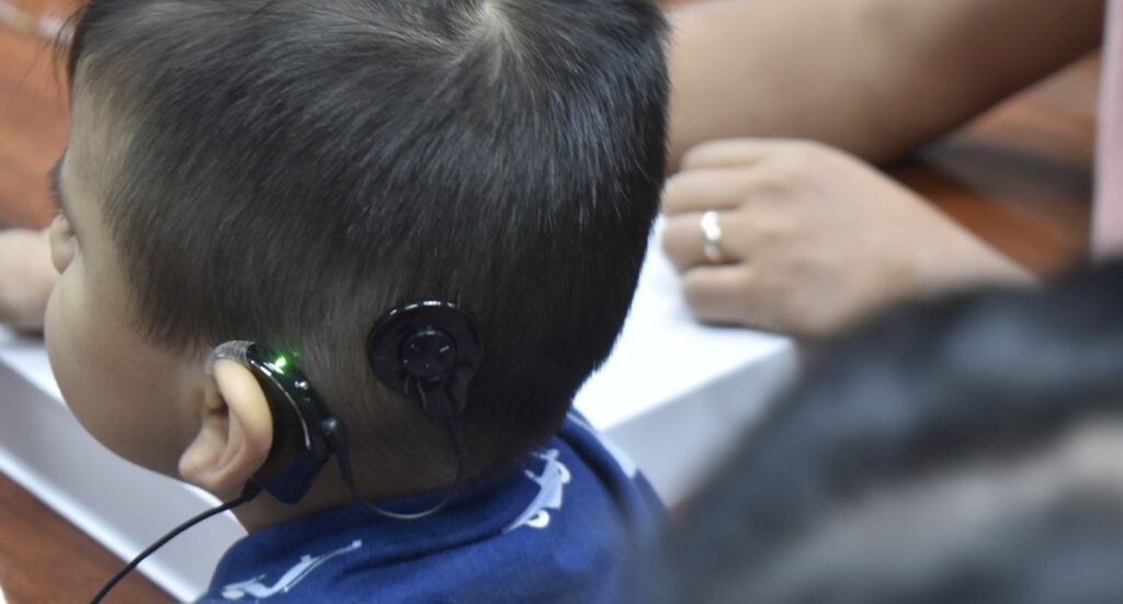 IMSS realiza histórico implante coclear a niño en Monterrey